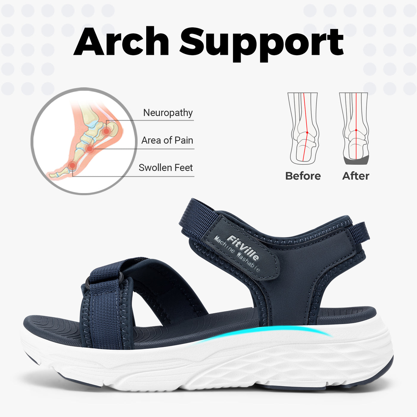 HeelHalo Orthopedic Sandals